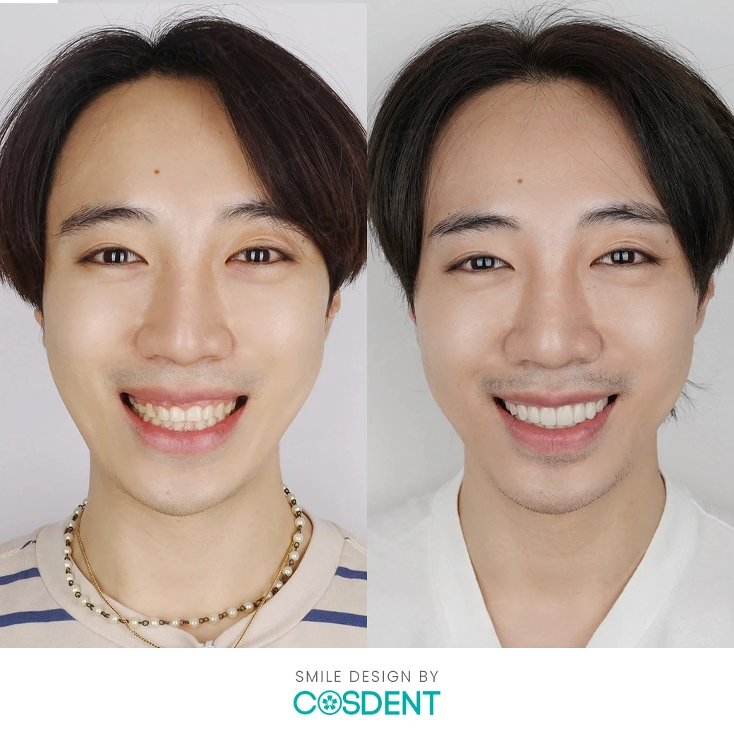 ผลงานการเปลี่ยนแปลงรอยยิ้มที่ COSDENT