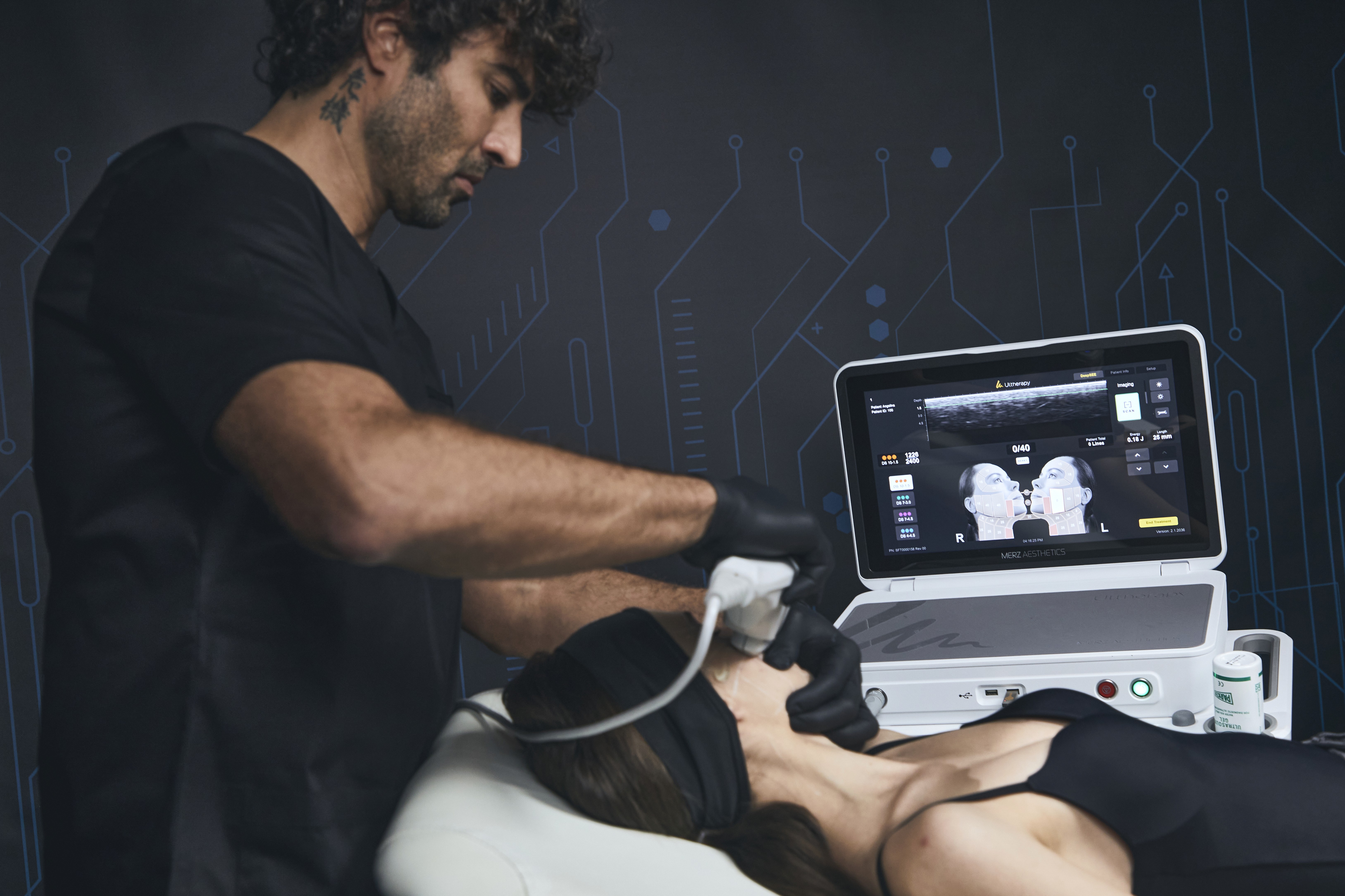 SkinPen® e Microneedling: la nuova frontiera per migliorare la qualità della pelle