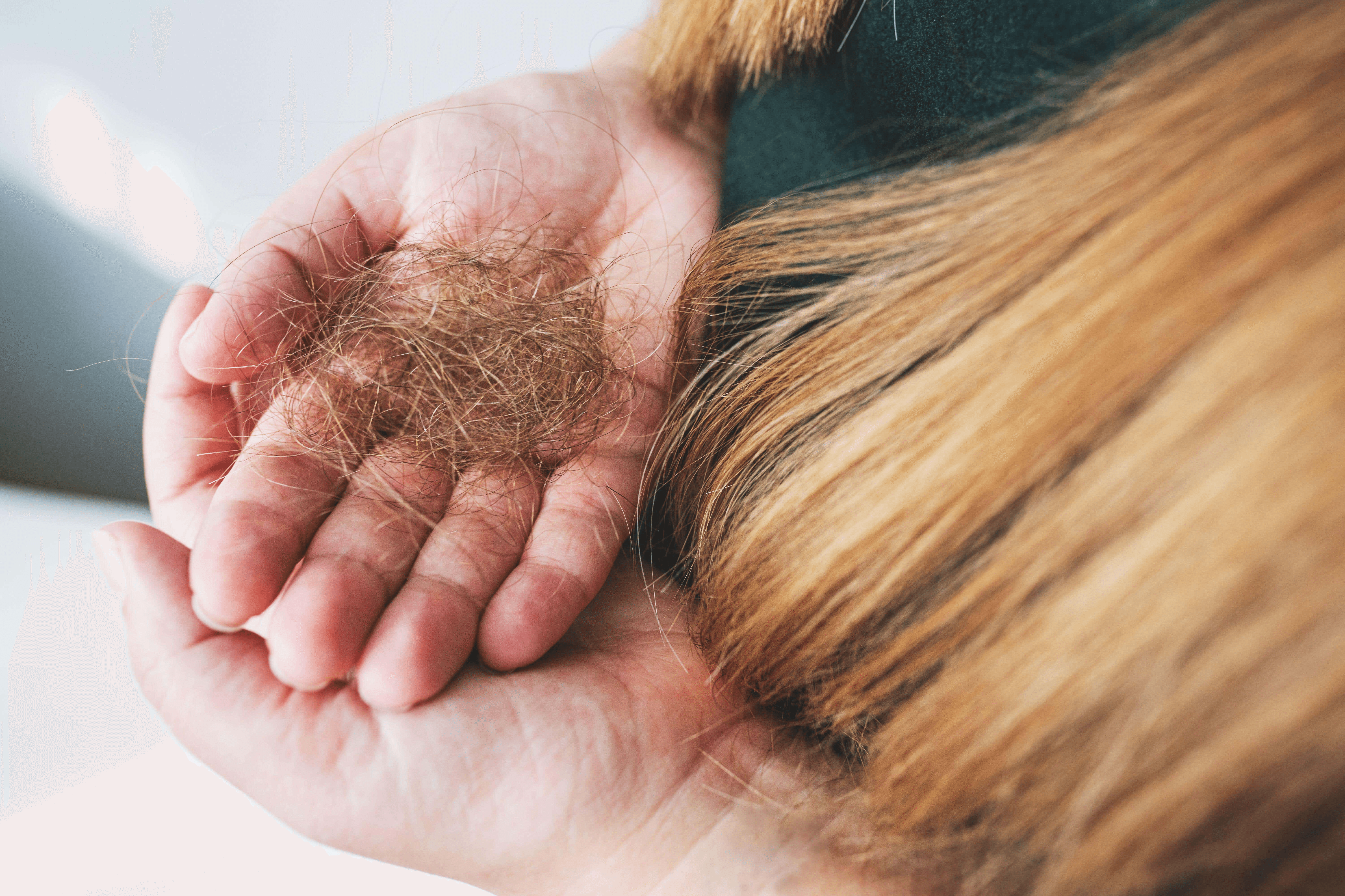 How to Prevent Hair Loss on Ozempic