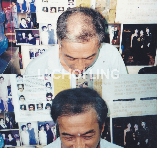 lichoiling casestudy