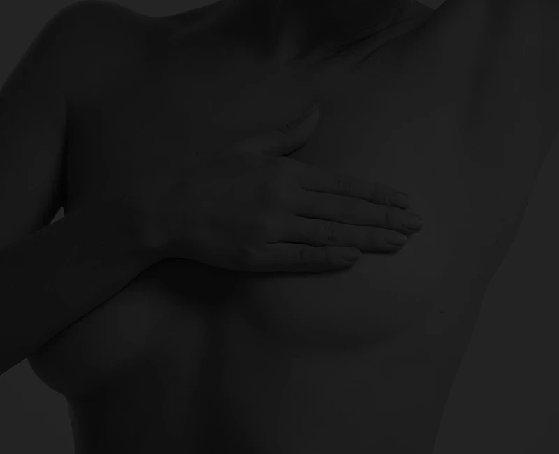 "mastopexia — reposicionamento de mamas flácidas, com ou sem prótese