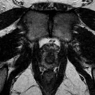 Image of a gender health scan