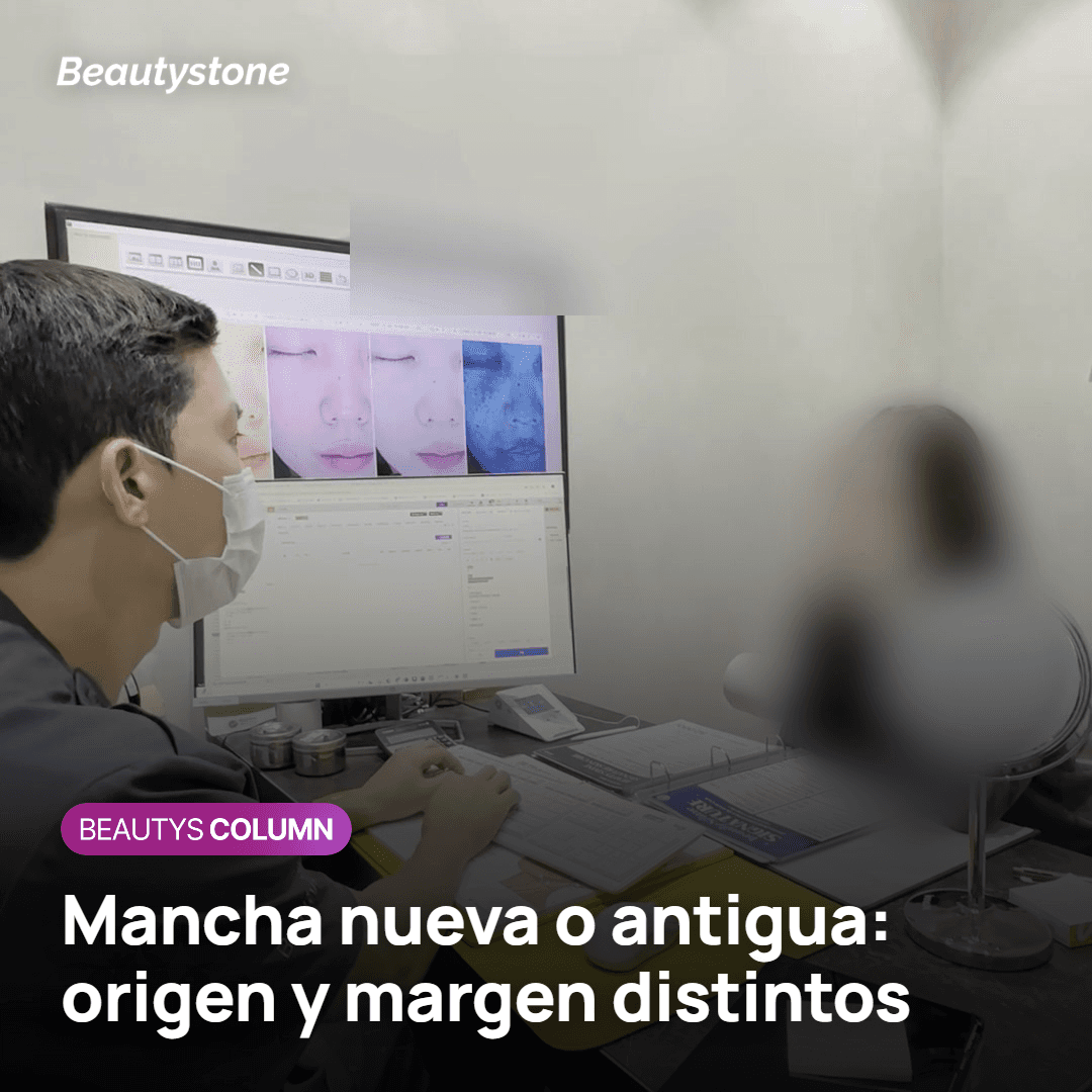 Diferencias entre una mancha antigua y una mancha que aparece después del láser