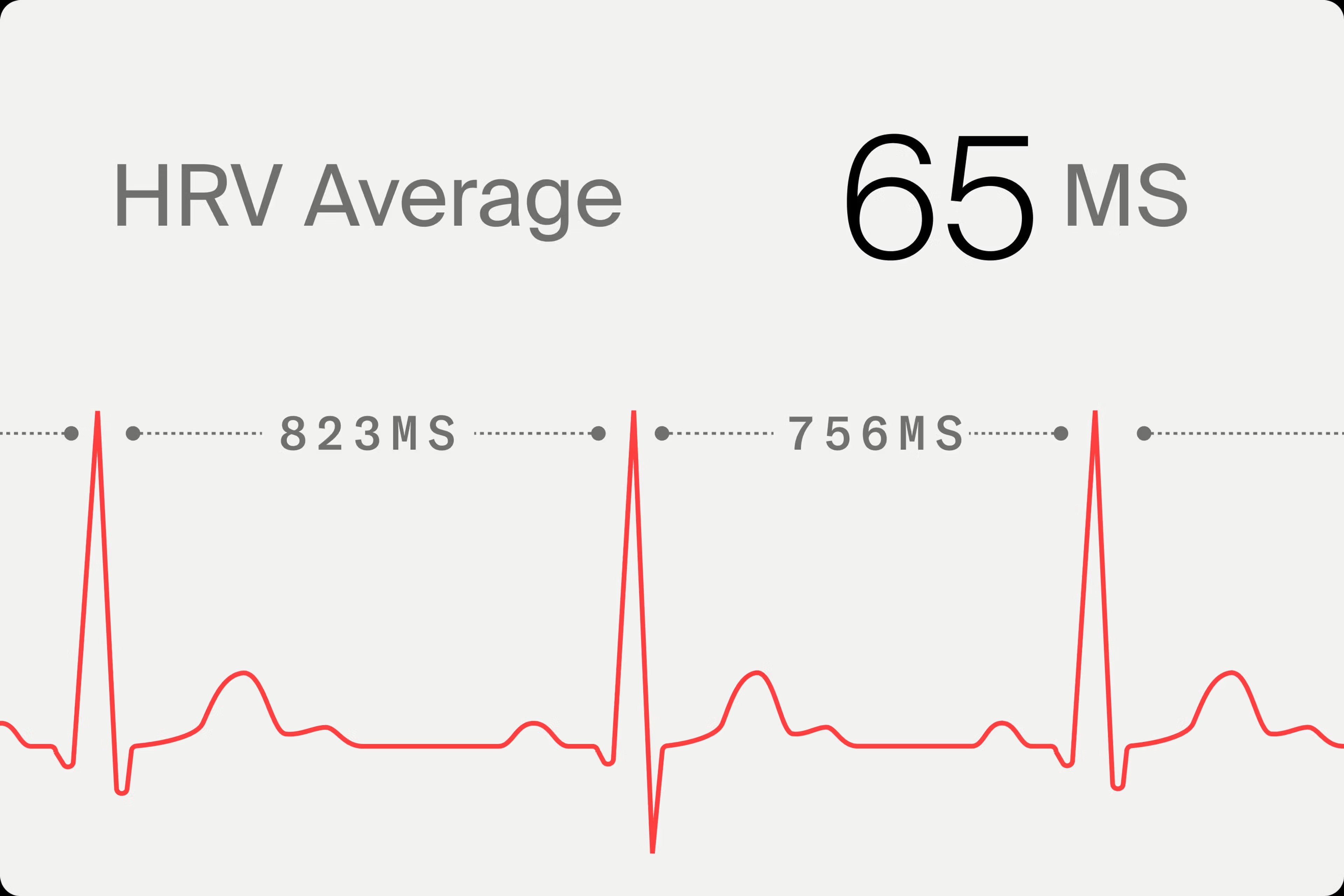 Tracé d’électrocardiogramme rouge sur fond gris clair montrant une HRV moyenne de 65 ms, avec des intervalles de 823 ms et 756 ms entre deux battements de cœur
