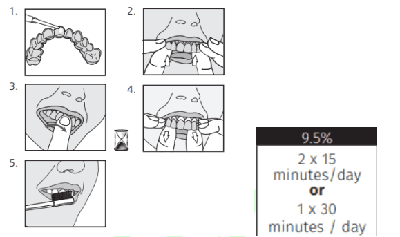 Instructions for loading and wearing an at-home whitening tray
