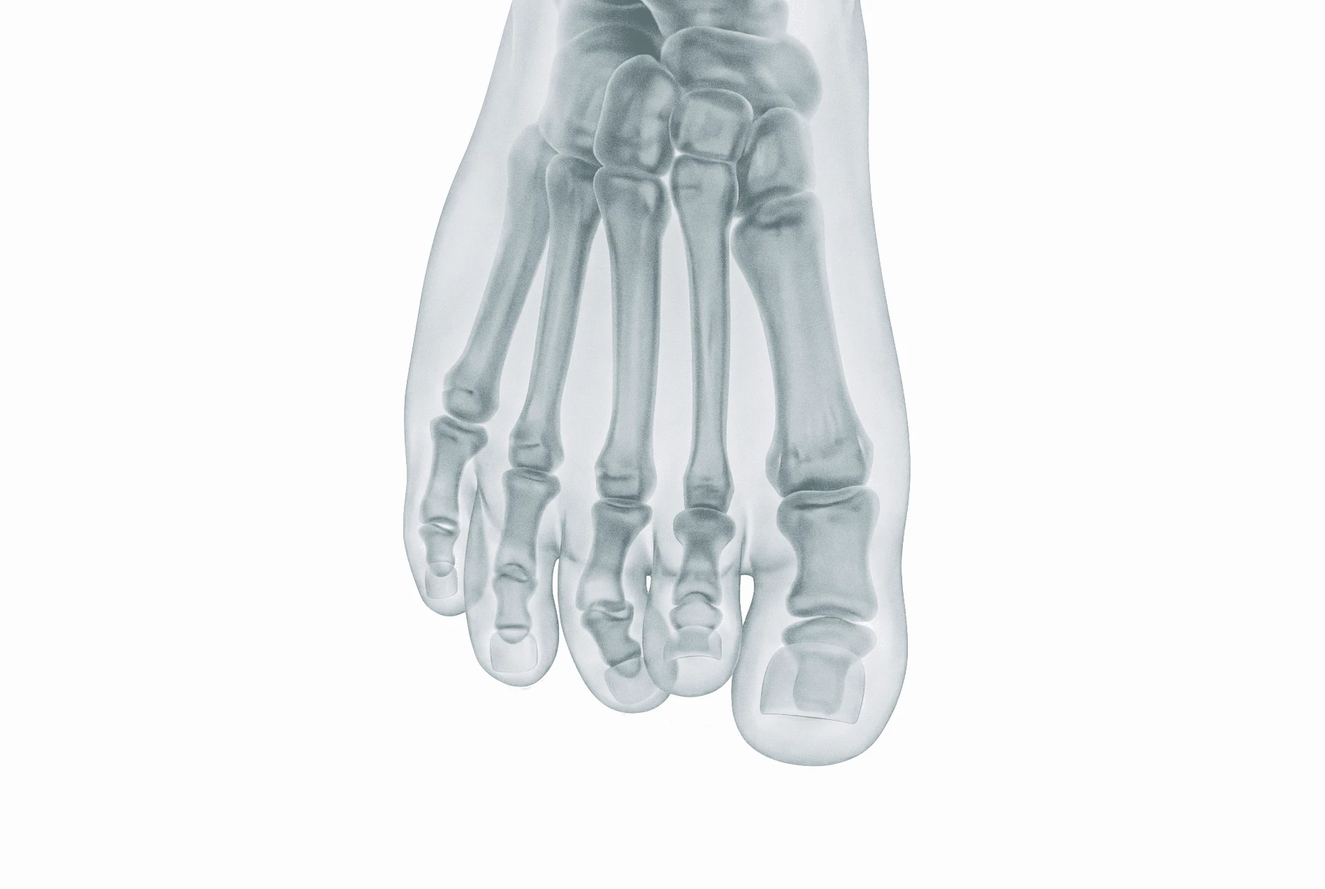 Child Curly Toes