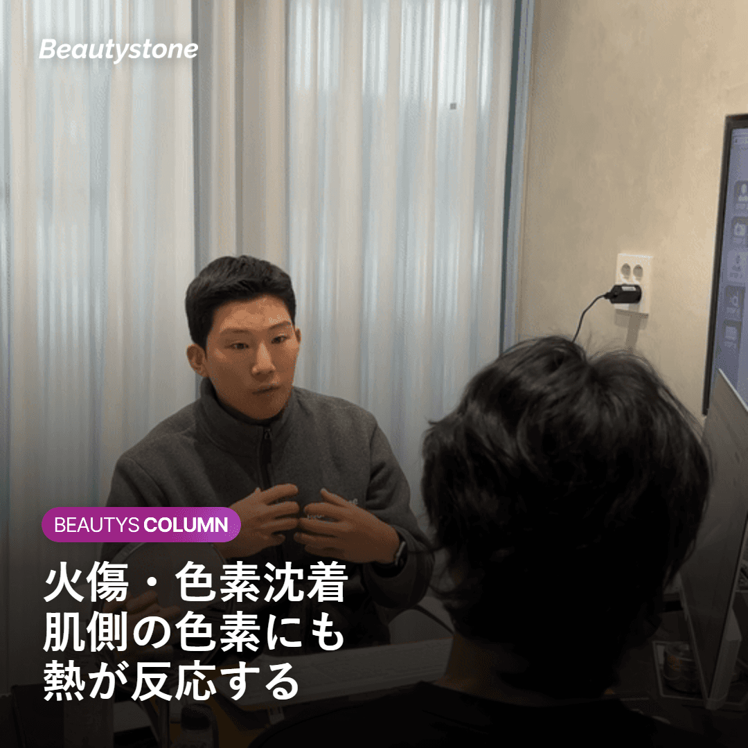 火傷や色素沈着など日焼け肌のレーザー脱毛リスクを示すイメージ