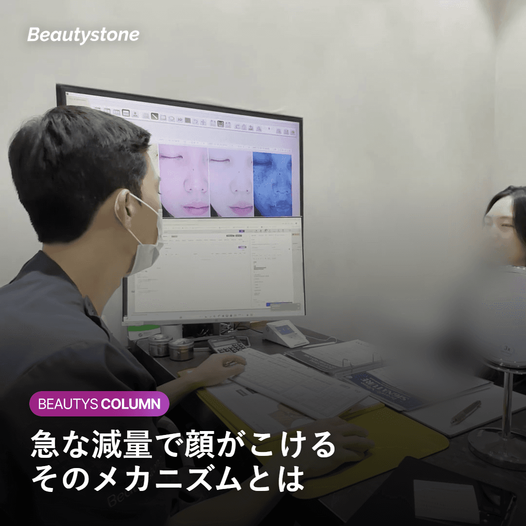 ダイエット後に顔がくぼむのはなぜ？