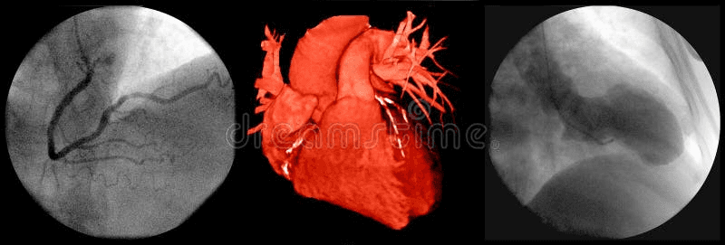 Cardiac imaging