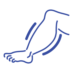 하지정맥류 아이콘_부종