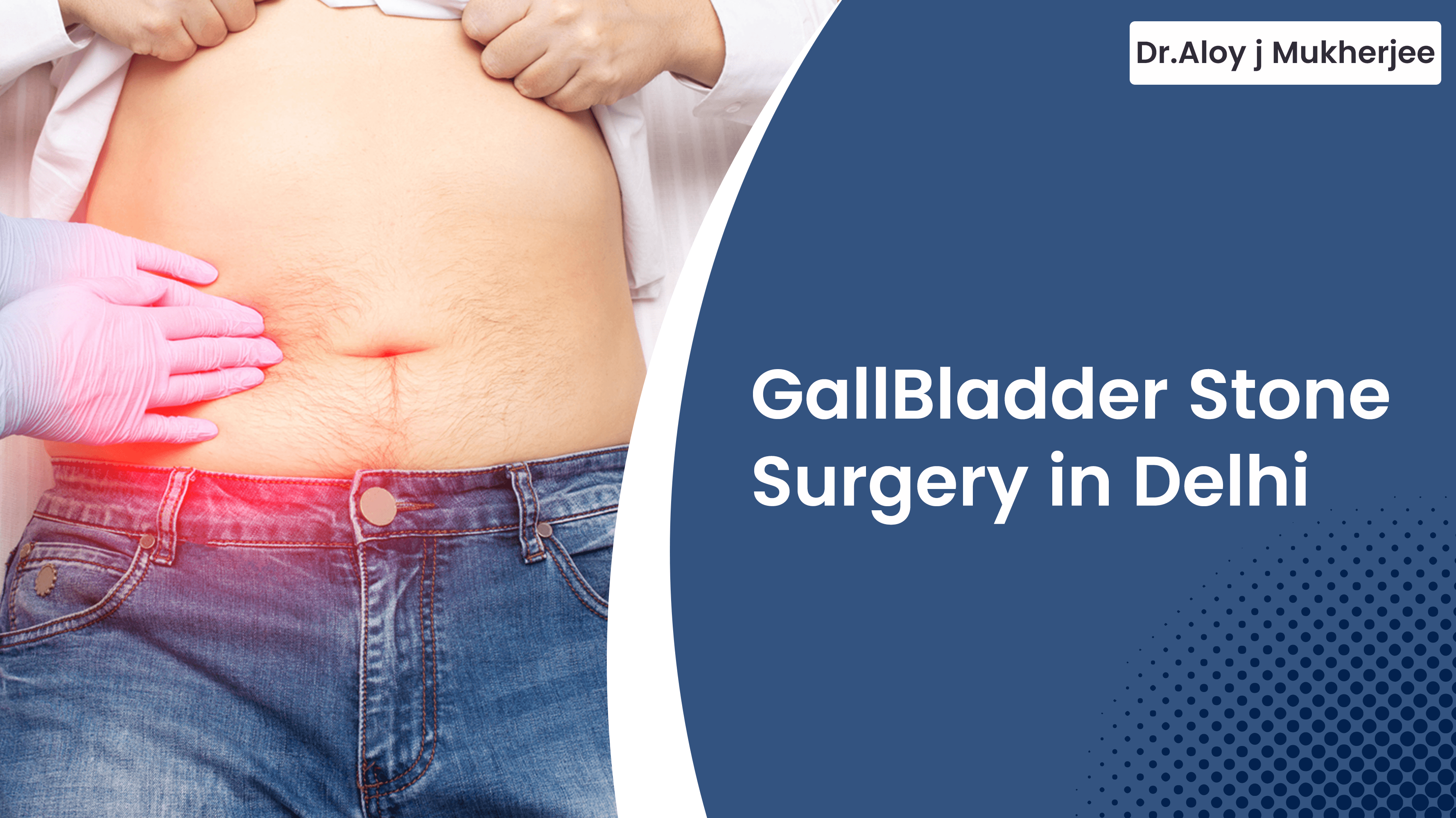 GallBladder Stone Surgery in Delhi