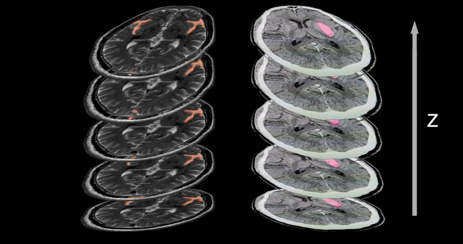 MRI Slices Annotated