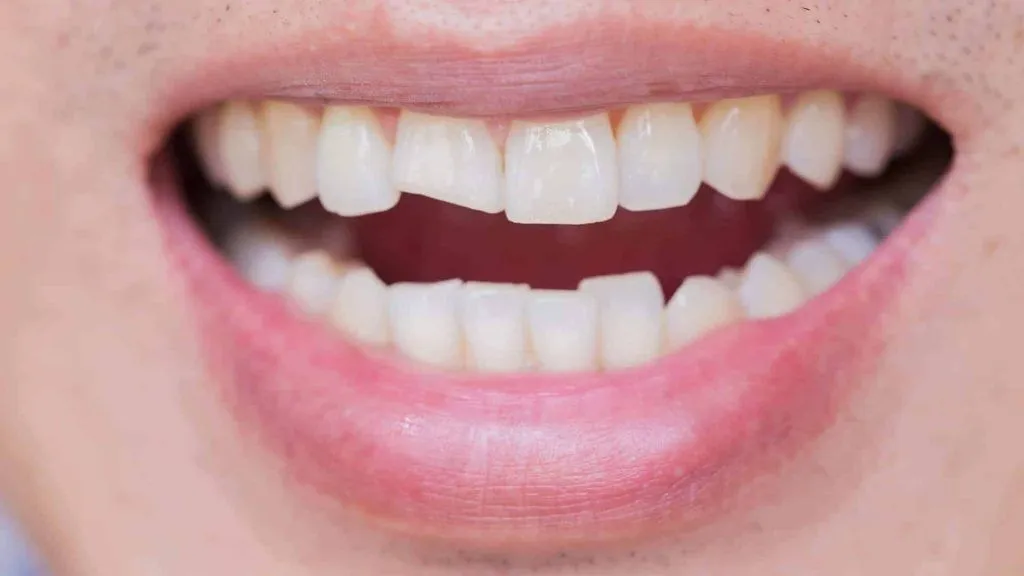 Smyrna Dental Team