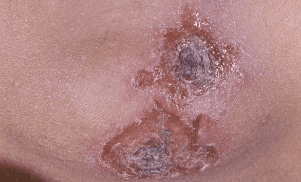 a pile of pills sitting next to each other on top of a table