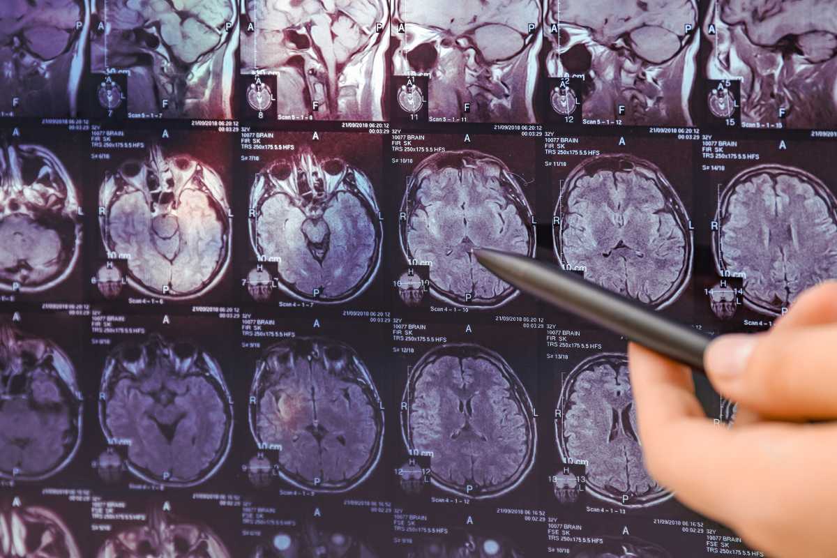 Neurologist with his Patient