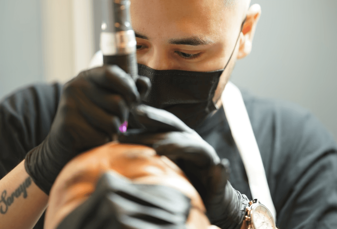 Scalp & Brows, Skalp Mikropigmentering för Ärrkamouflage i Stockholm