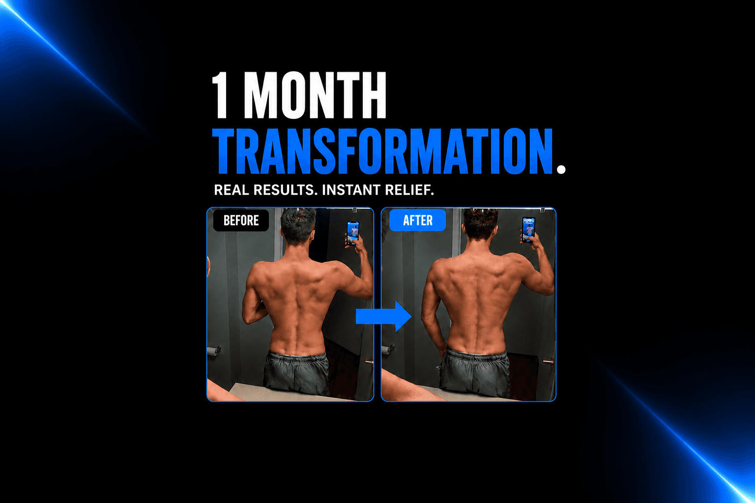 Scoliosis Transformation - The Scoliosis Coach