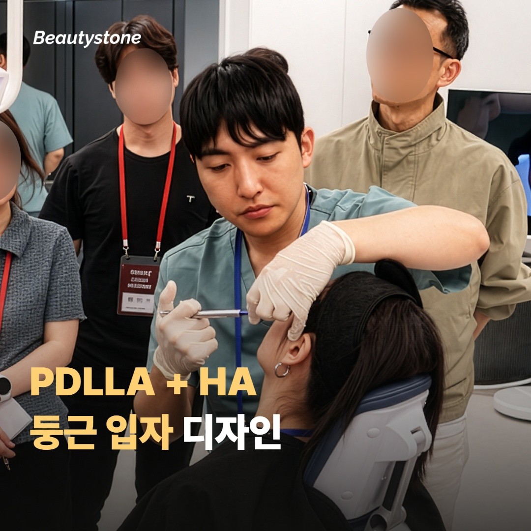 PDLLA + HA, 결절 위험을 가장 낮춘 조합
