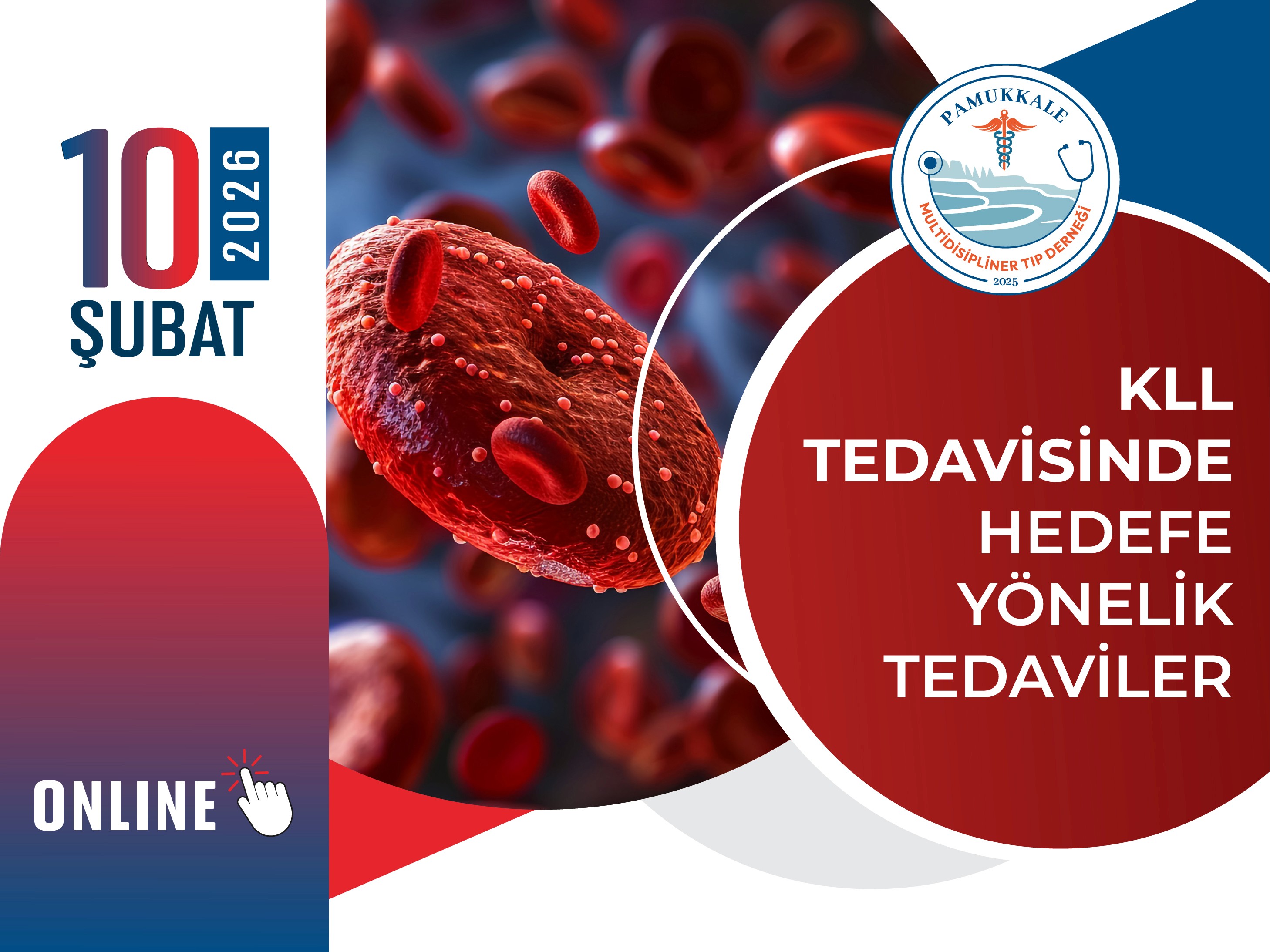 kll-tedavisinde-hedefe-yonelik-tedaviler