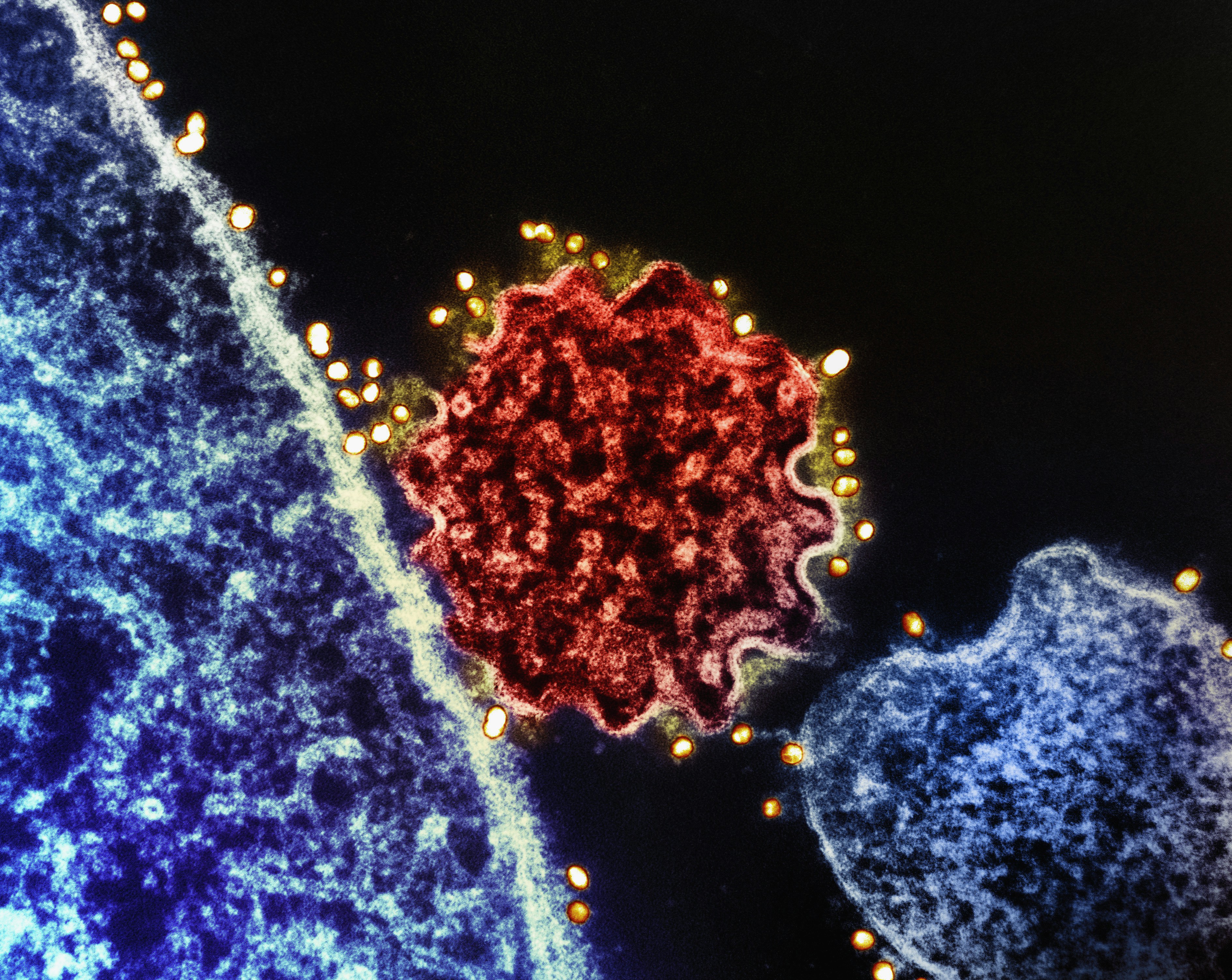 Photo by National Institute of Allergy and Infectious Diseases on Unsplash