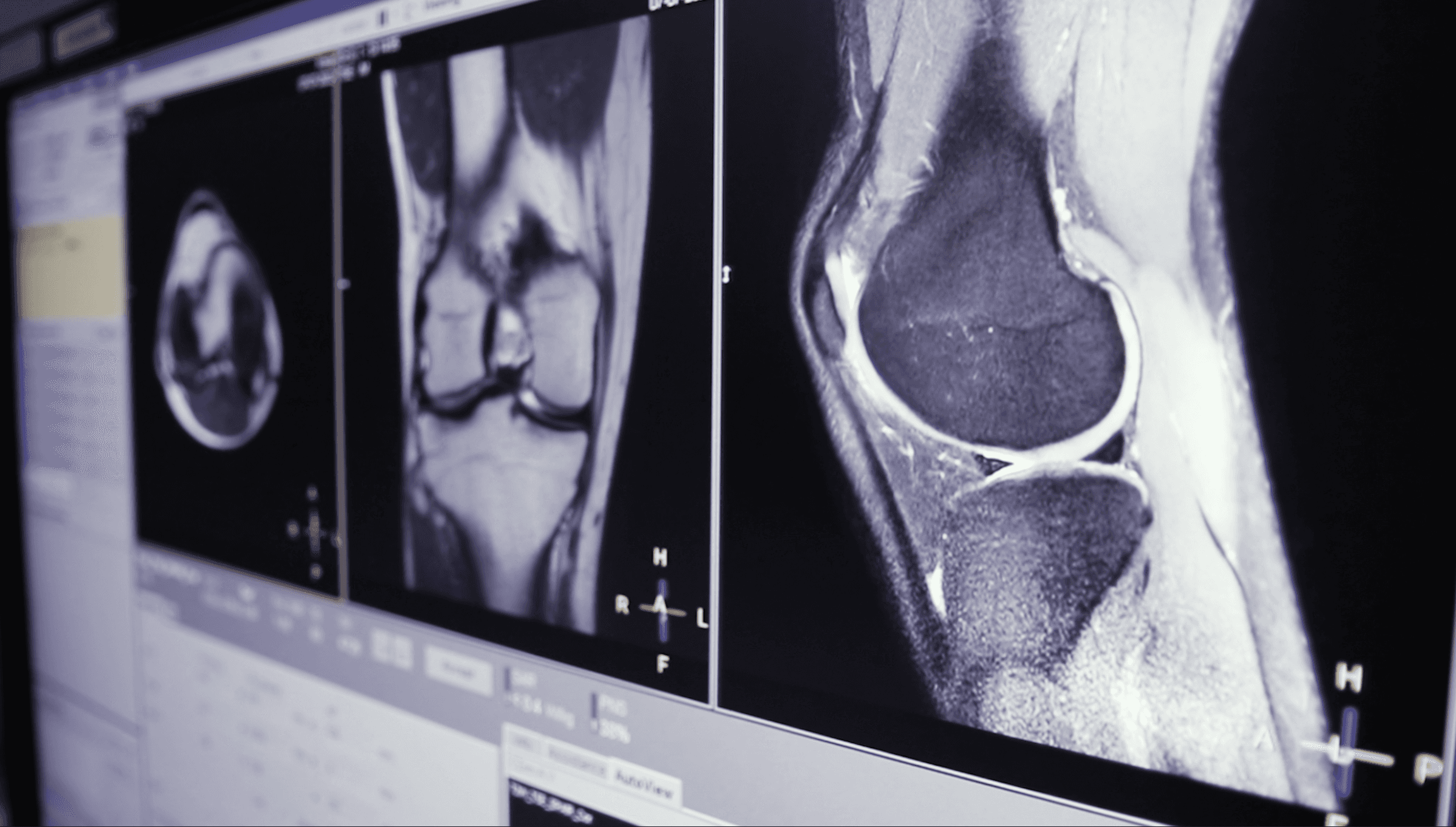 Close-up of a person holding two virtual reality controllers in front of a blurred Ellumen logo—symbolizing immersive technology or VR simulation use.