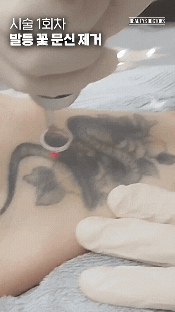 소형 검정부터 대형 혼합까지: 문신 크기별 현실적인 비용과 기간 시뮬레이션