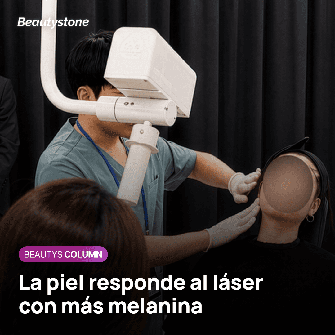 Piel que produce más melanina tras el estímulo del láser toning