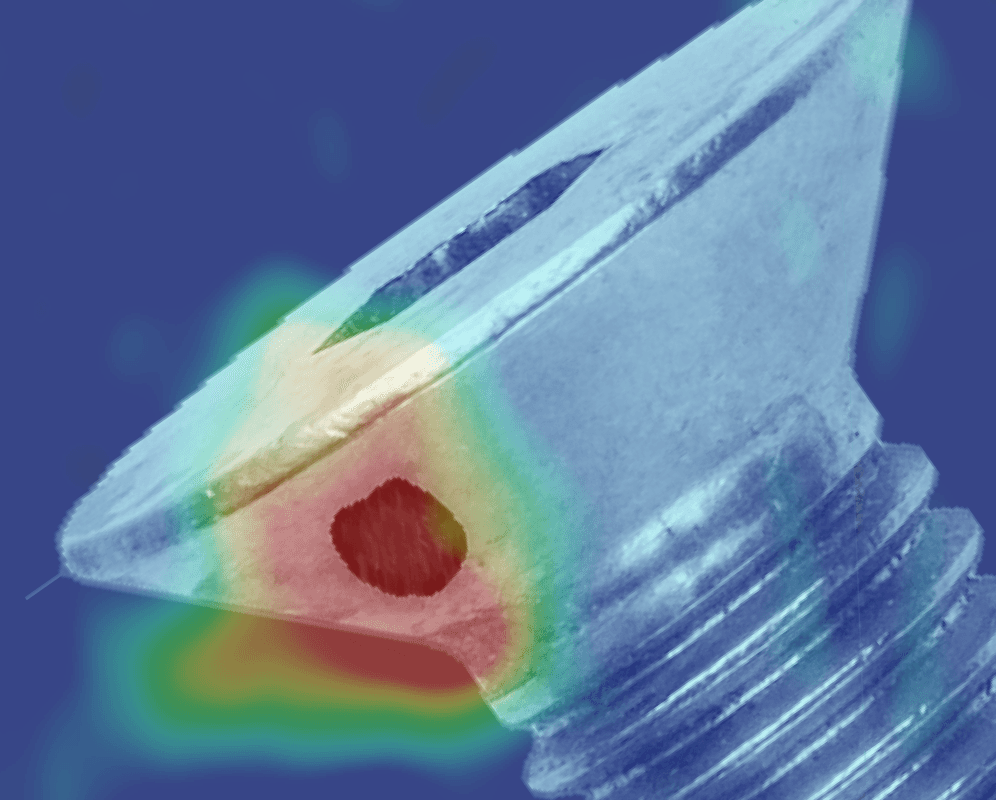anomaly classification