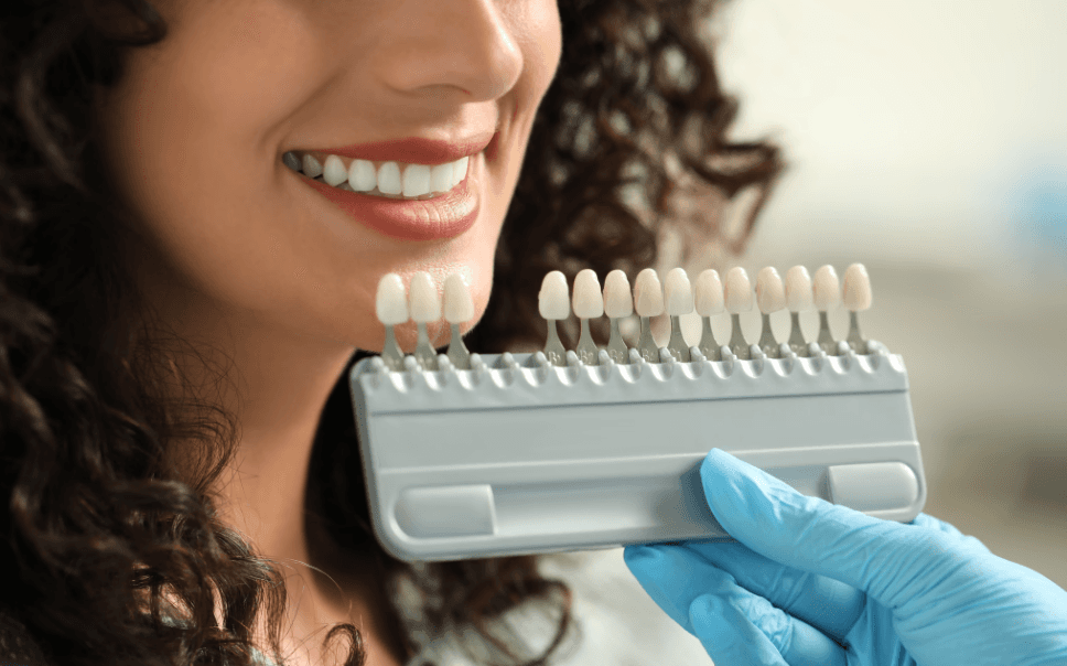 types of veneers at the invisalign center in dubai