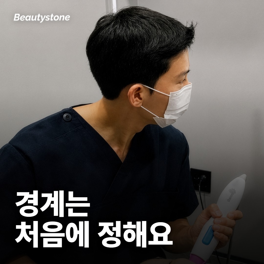 어디까지 없앨지, 꼭 처음에 정해야 해요?