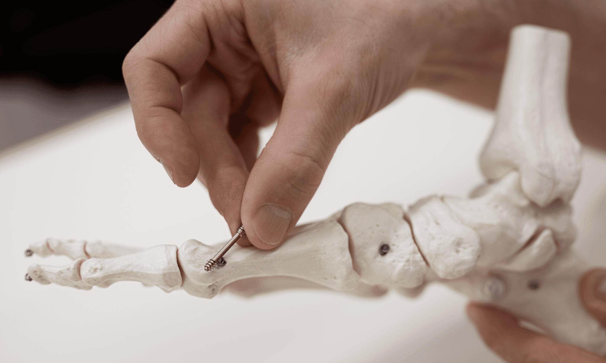 Eine Hand hält eine chirurgische Schraube an ein anatomisches Modell eines Fußes