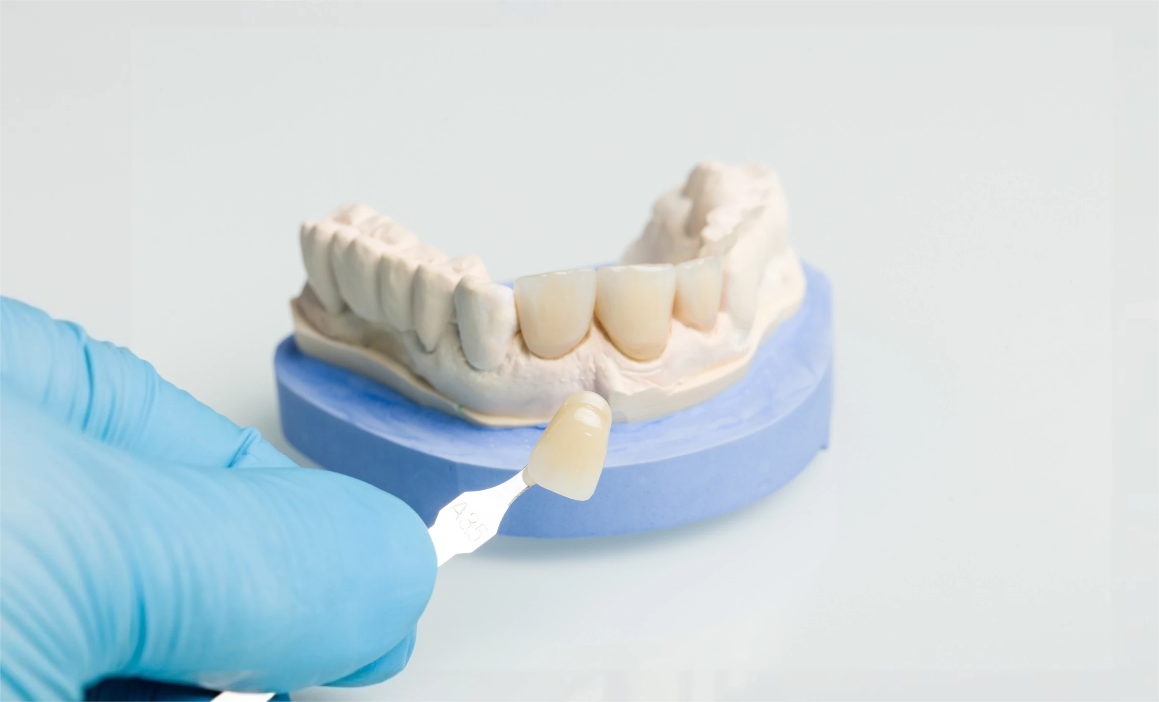 Skalfasader på tandmodell