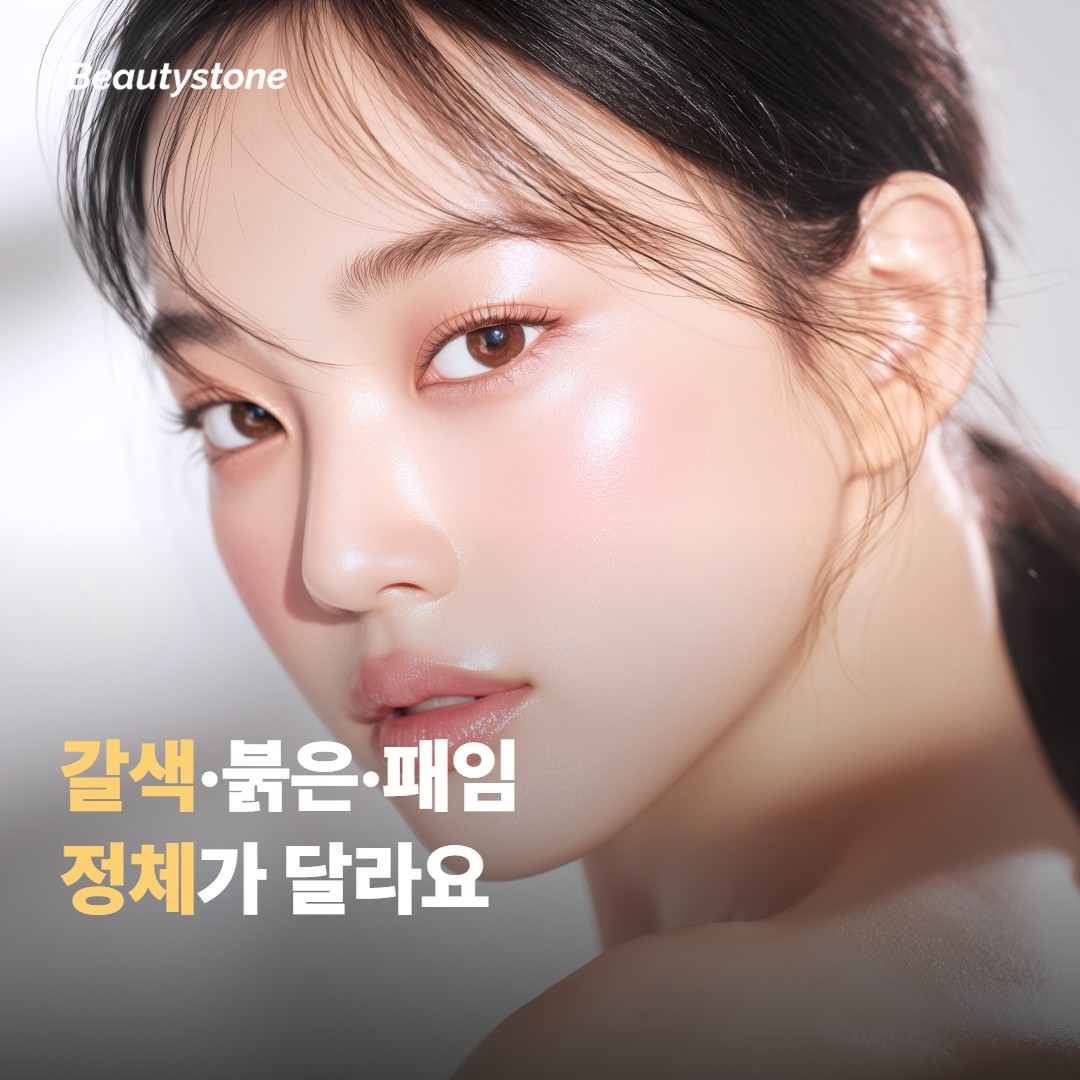 자국이 어떤 종류인지부터 가려야 해요