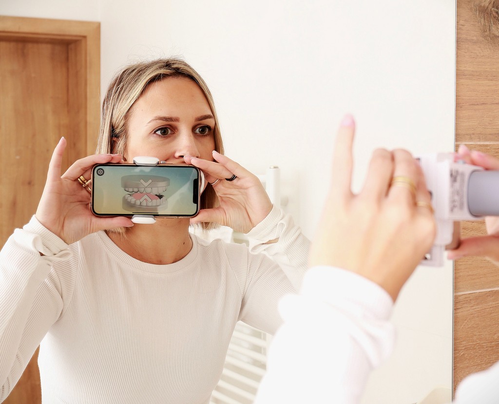 Dental monitoring