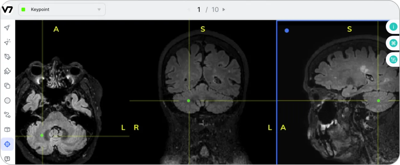 multi-view medical scan in v7