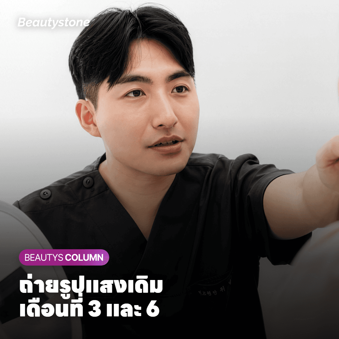 ผิวบริเวณแนวกรามแดงเล็กน้อยหลังทำ Oligio X ขณะประคบเย็น