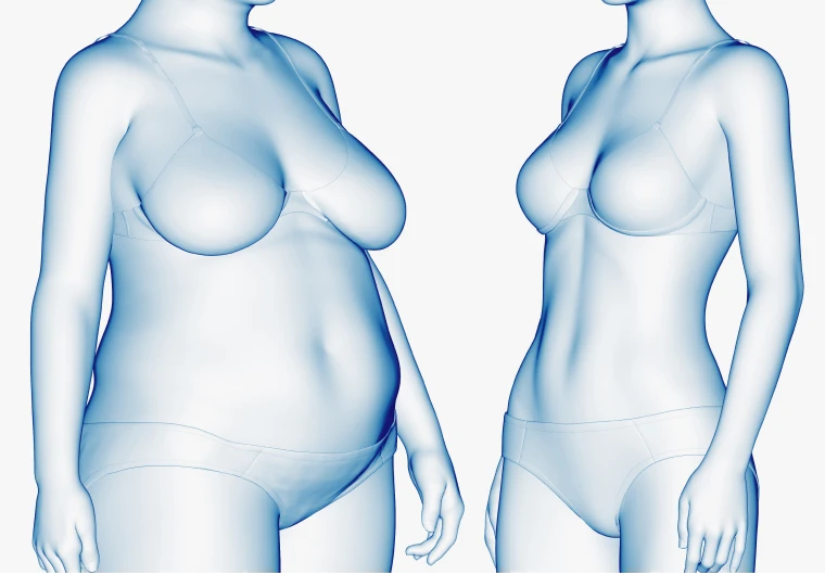 재활_메디컬리포밍_변화_인포그래픽_르샤인-재발방지