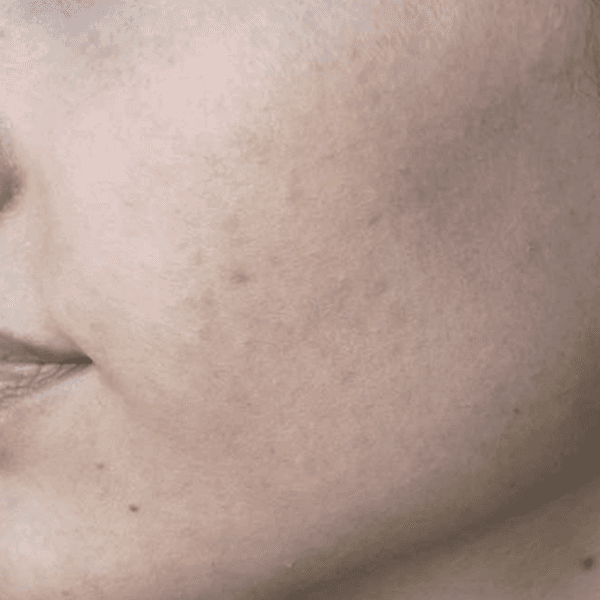 Clear + Brilliant After