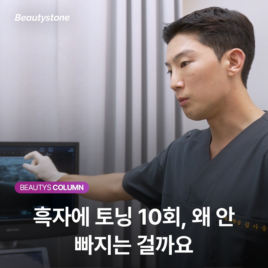 "레이저토닝 10회 받아도 안 빠지는 까만 점" — 혹시 주근깨가 아니라 흑자 아닌가요?