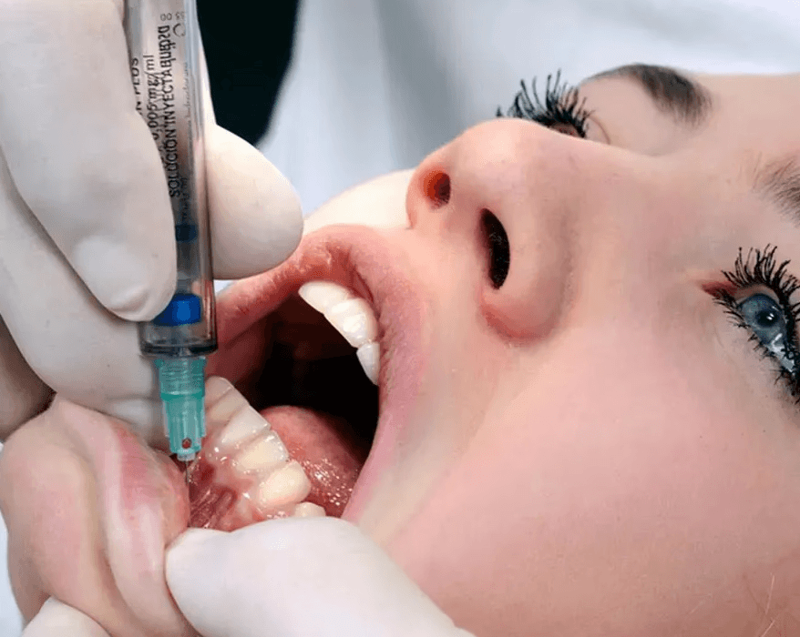 Dentist administering a local anesthetic injection to a patient using a Calaject computer-controlled delivery system