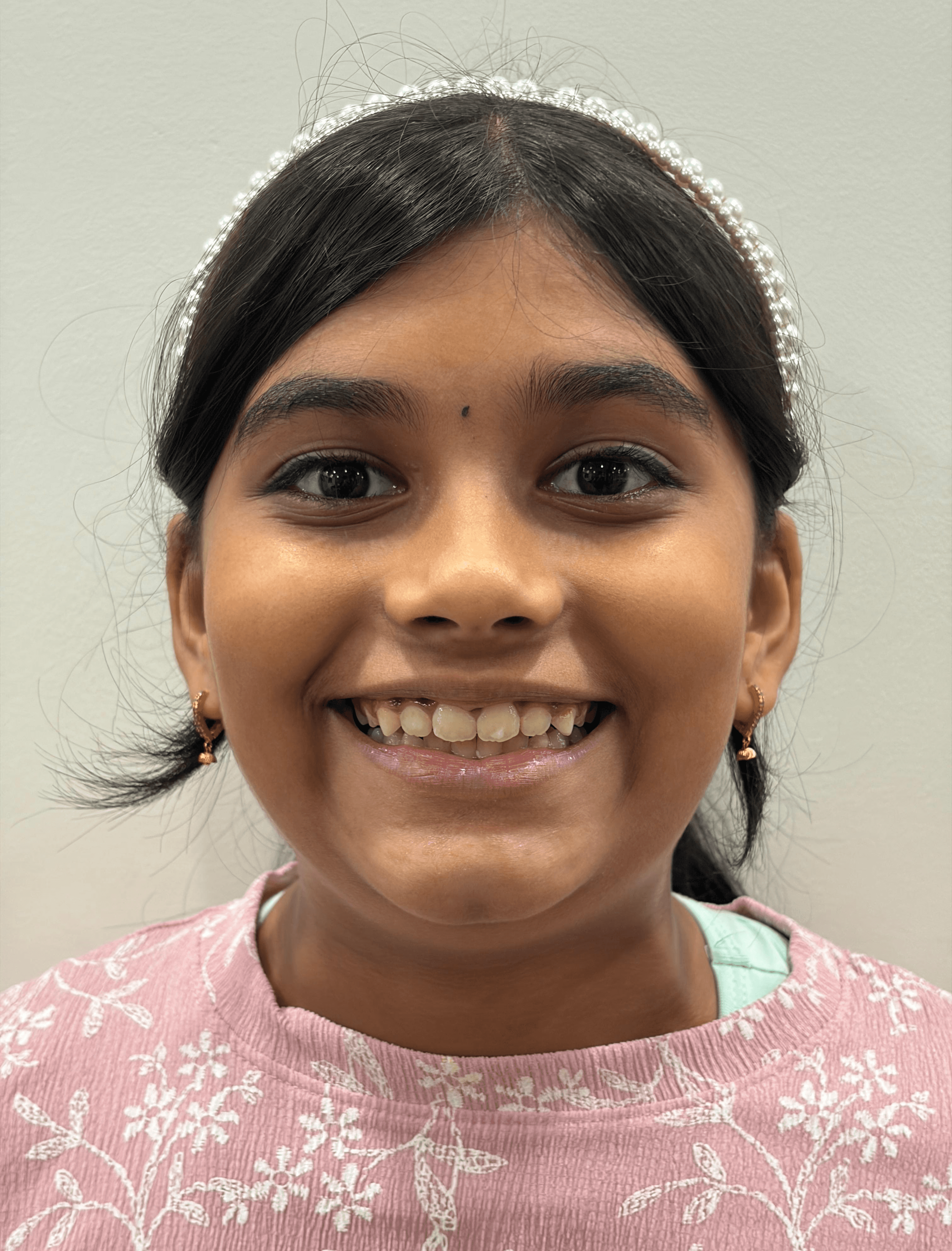 Close-up of smile with clean white teeth