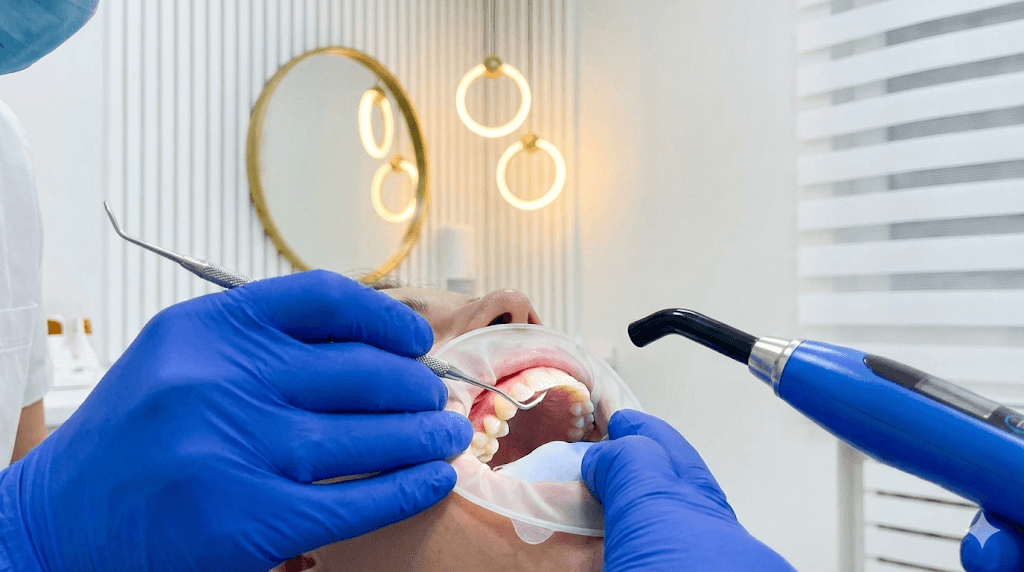 Close-up of tooth-colored composite resin being shaped to perfectly match a natural tooth.