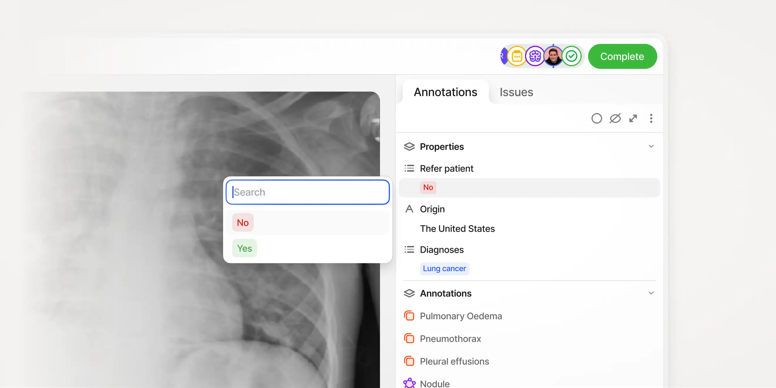 Annotating images with item level attributes