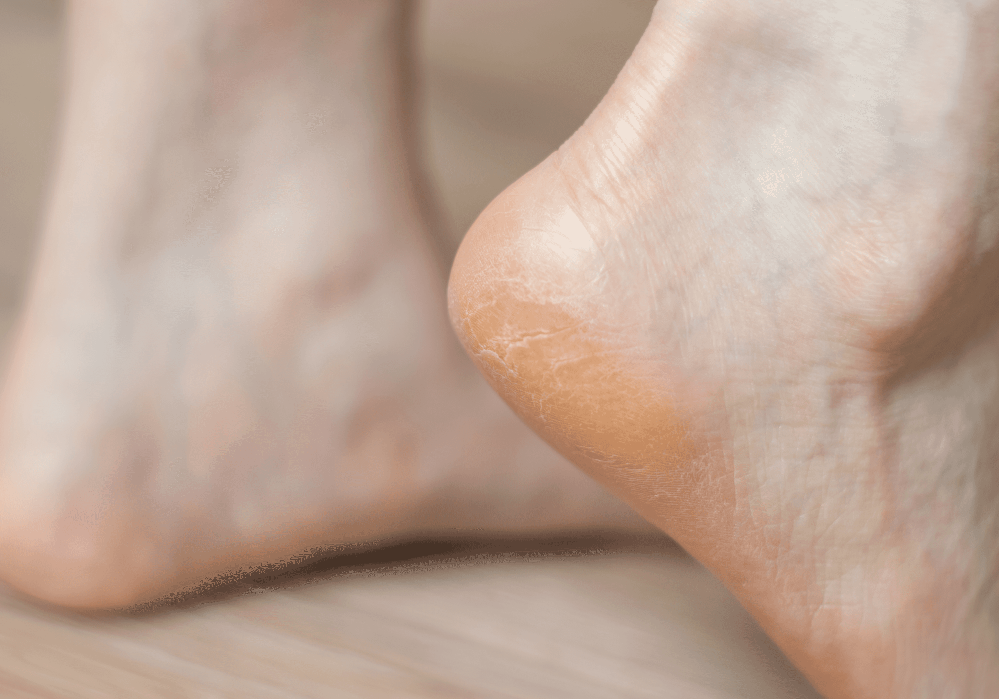 Callus