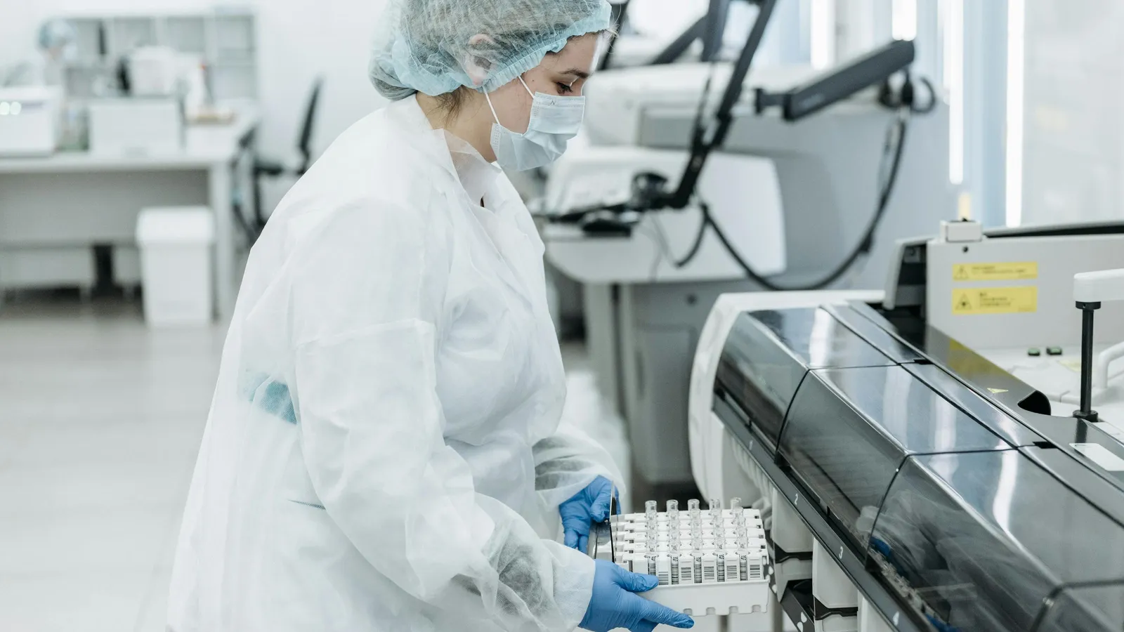 What Causes Elevated Urobilinogen?