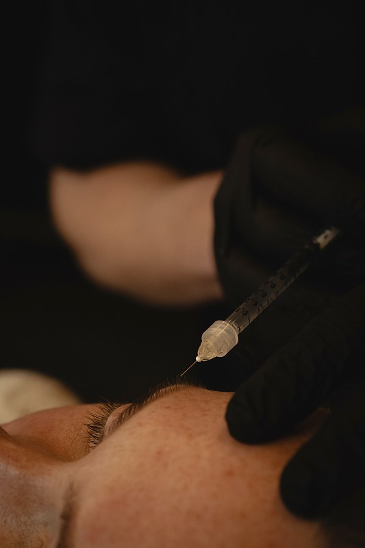 Huidkwaliteit & structuur