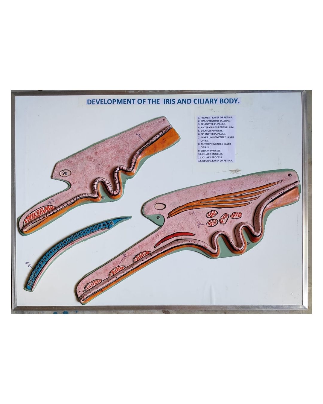 Development of the Iris and Ciliary Body