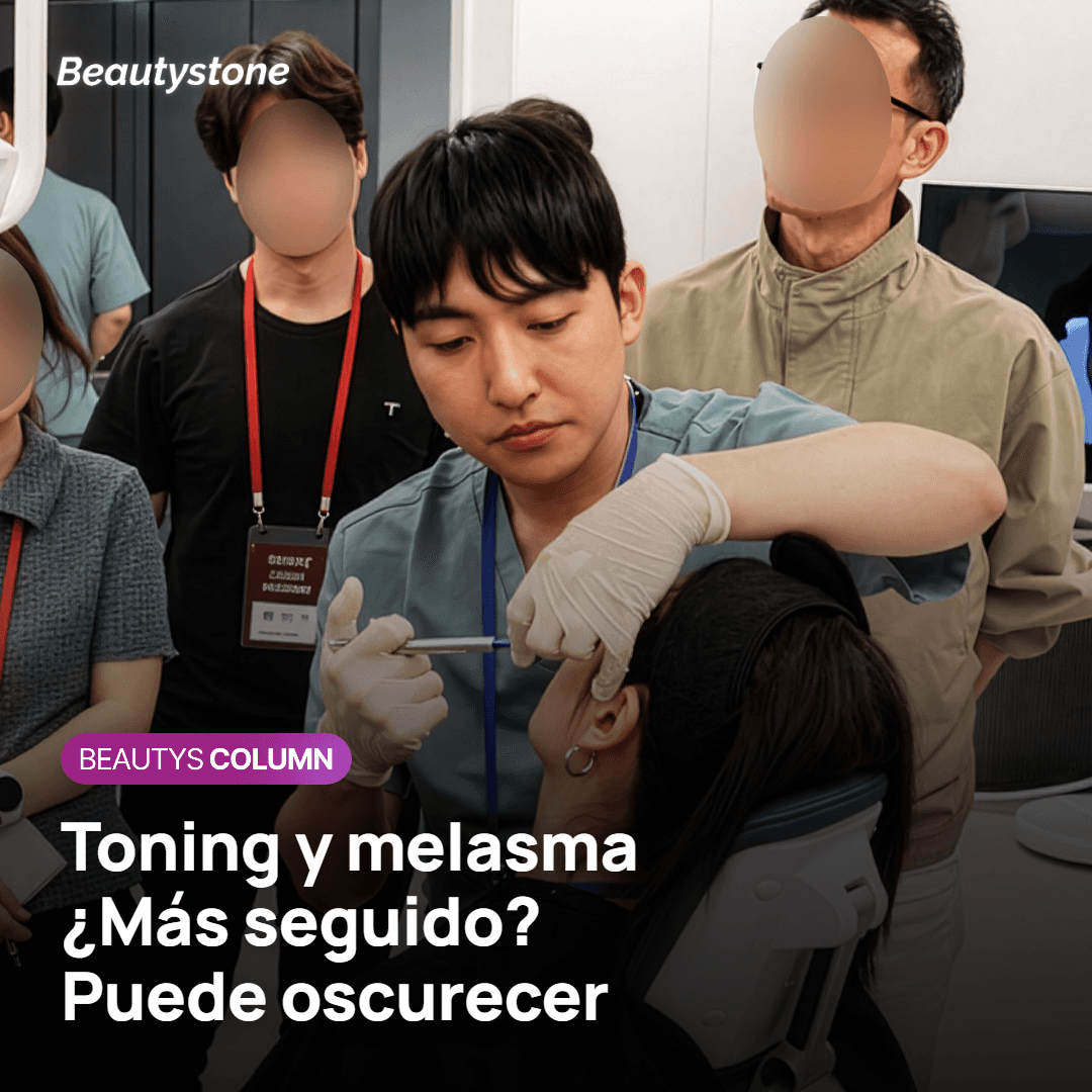Por qué el toning semanal puede oscurecer el melasma