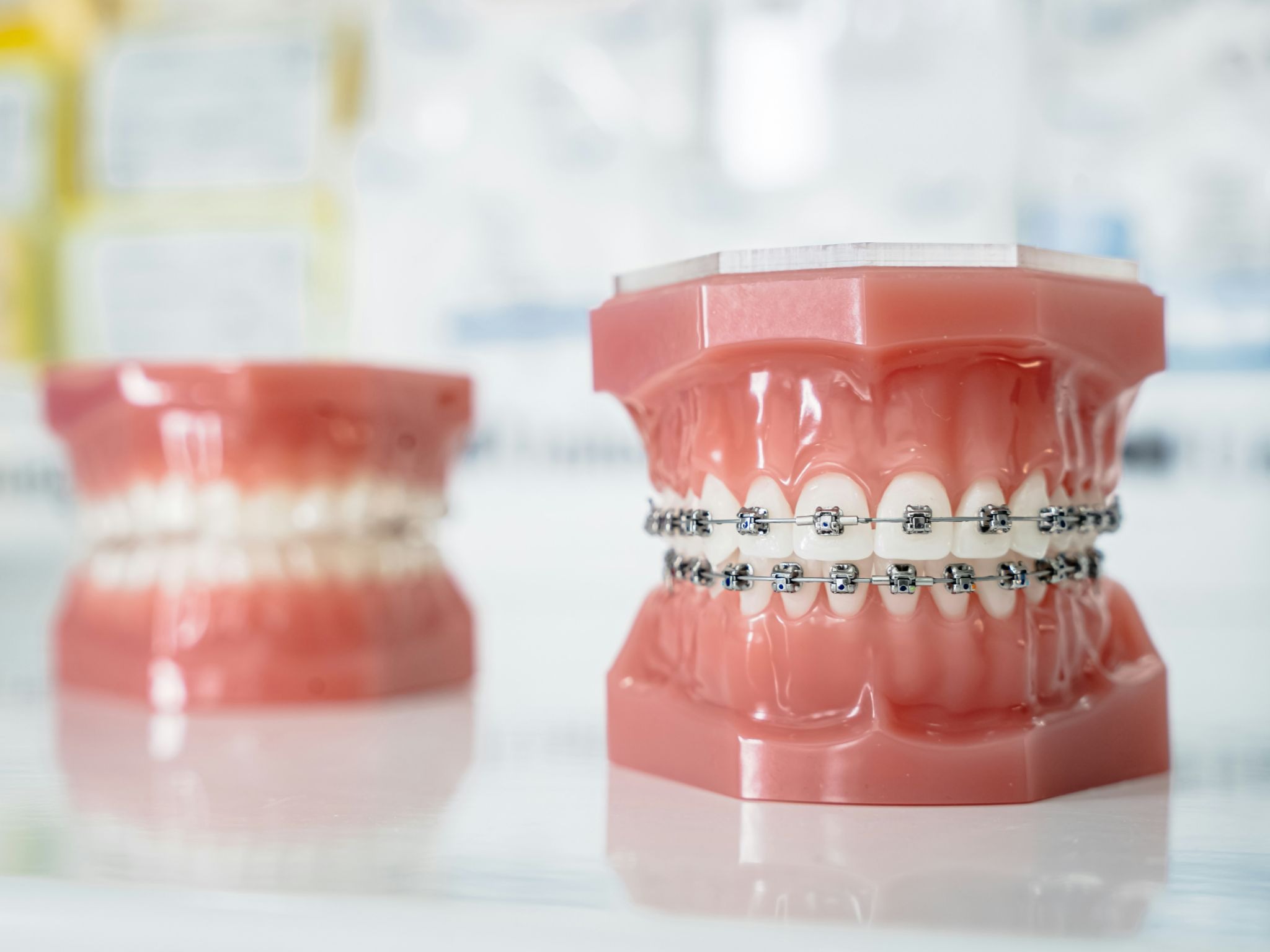How are Metal And Ceramic Braces Different?&nbsp;
