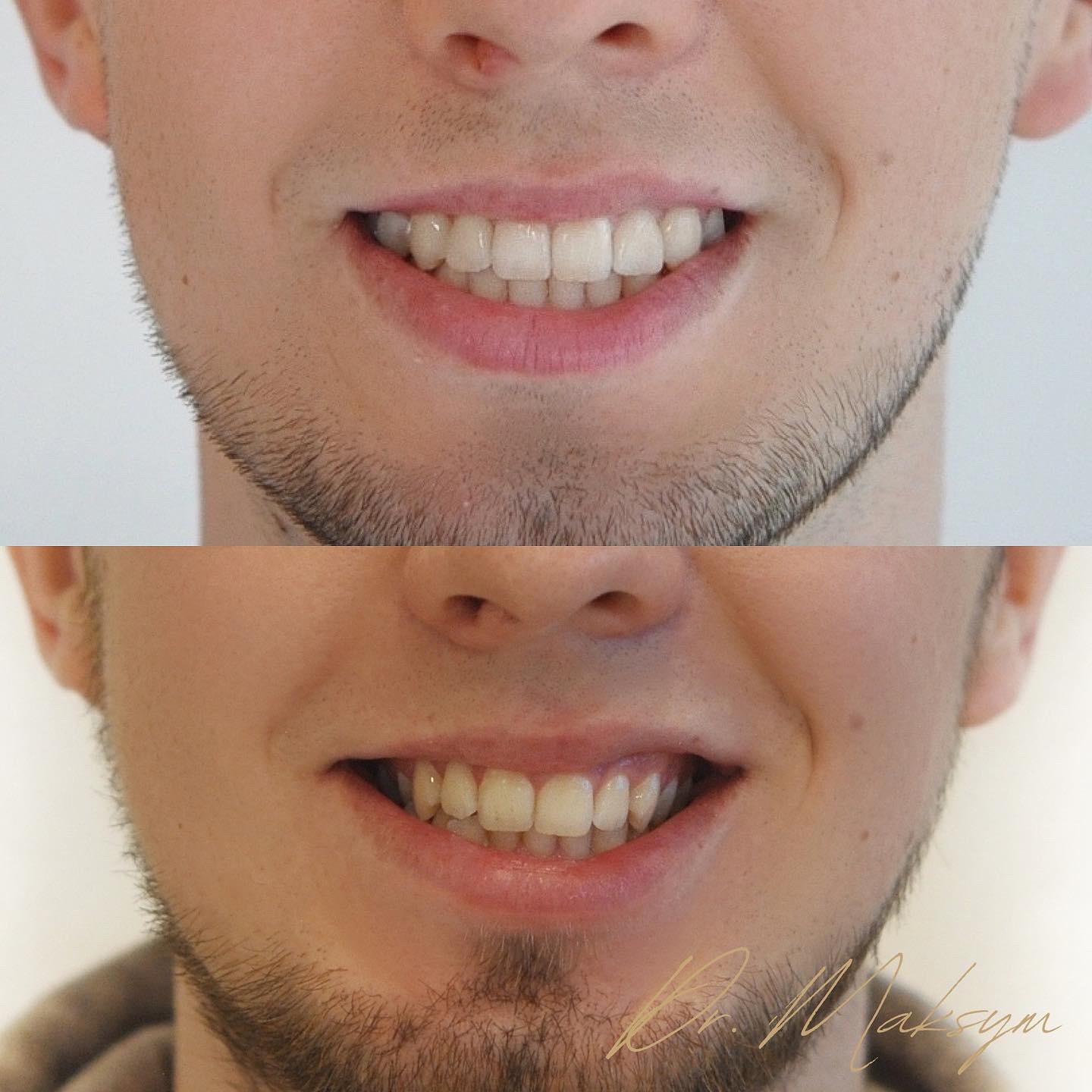 a person with the hand on the head